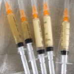 Platelet-Rich Plasma Market Poised For A Liftoff in 2018?