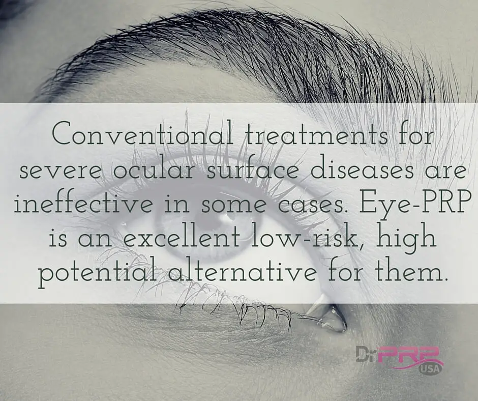 Eye PRP Treatment
