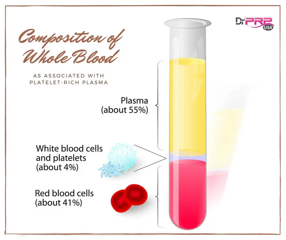 Composition of Whole Blood as associated with PRP