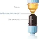 The Skincare Clinic Owner’s Guide To Platelet-Rich Plasma